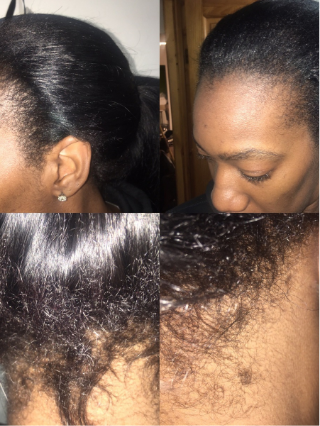 Creative Custom U-Wig Unit